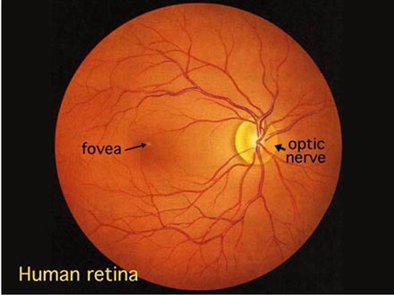 normal-retina